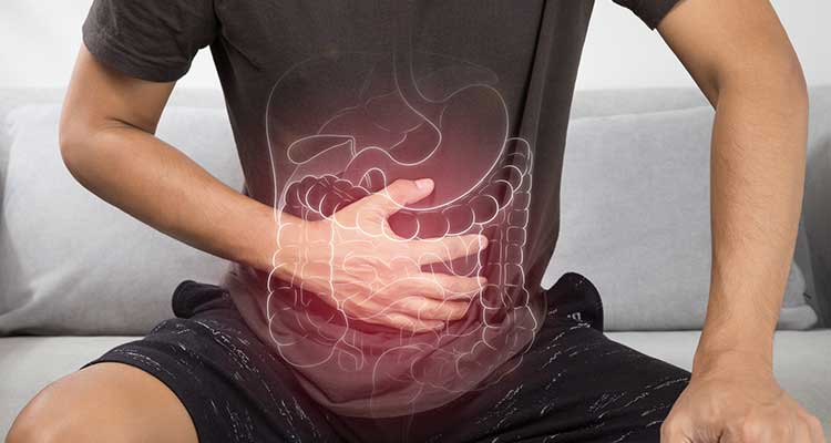 Diverticulose do Cólon