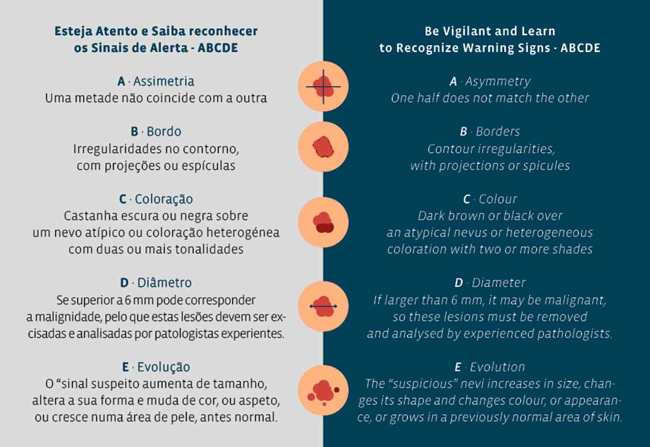 Sinais de Alerta - ABCDE