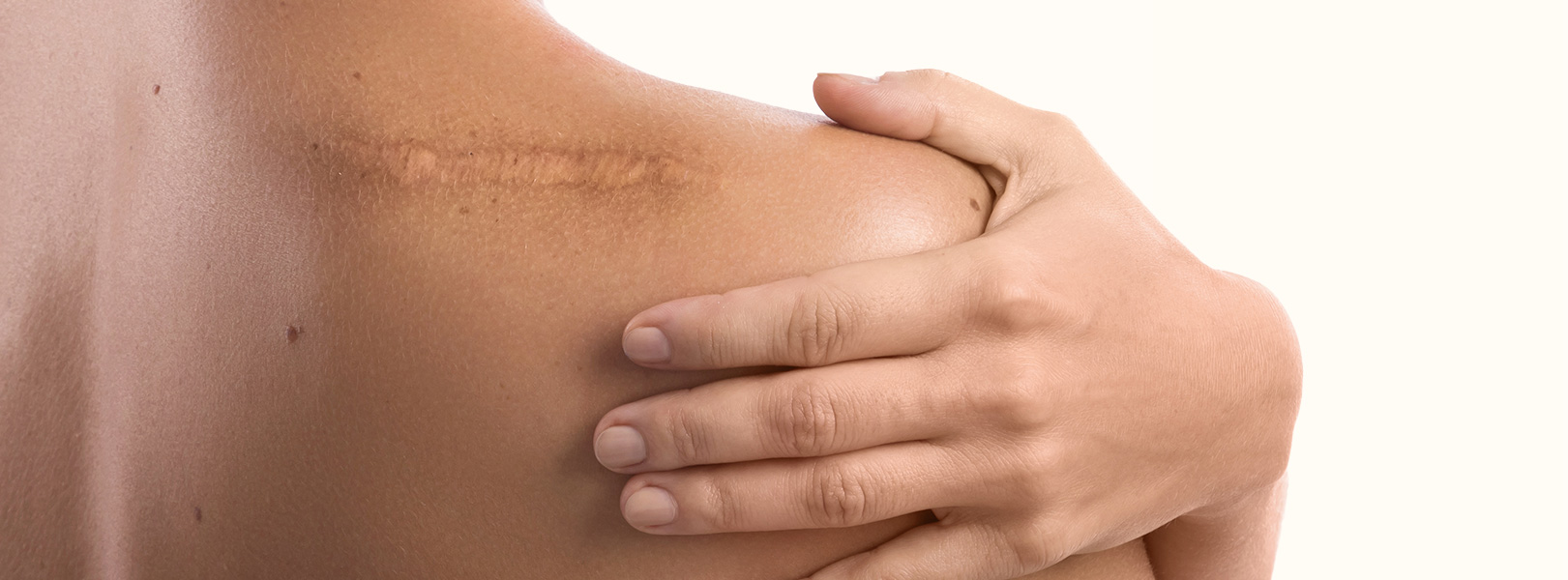 Reparação tecidual e o plasma rico em plaquetas