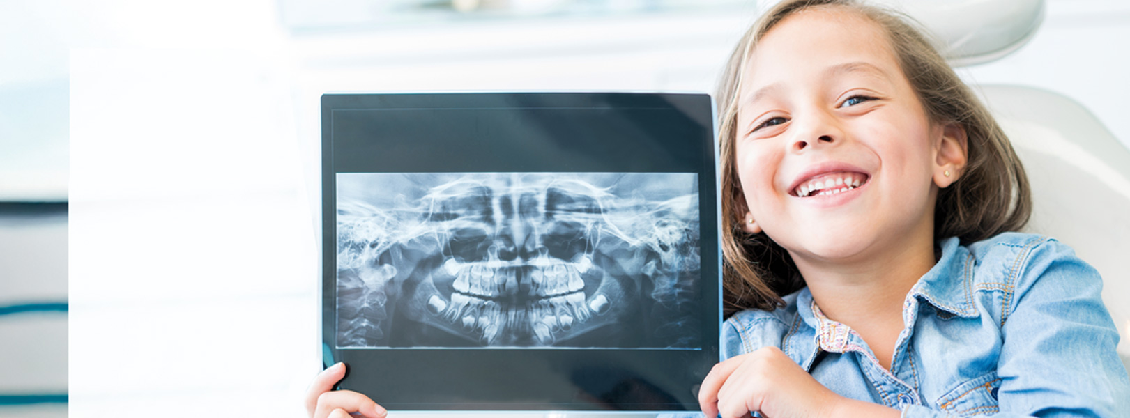 A importância dos dentes decíduos: Dentes de leite