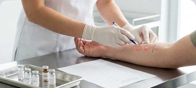 Testes Intradérmicos