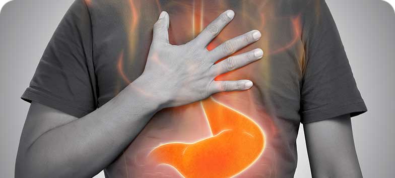 Refluxo Gastroesofágico