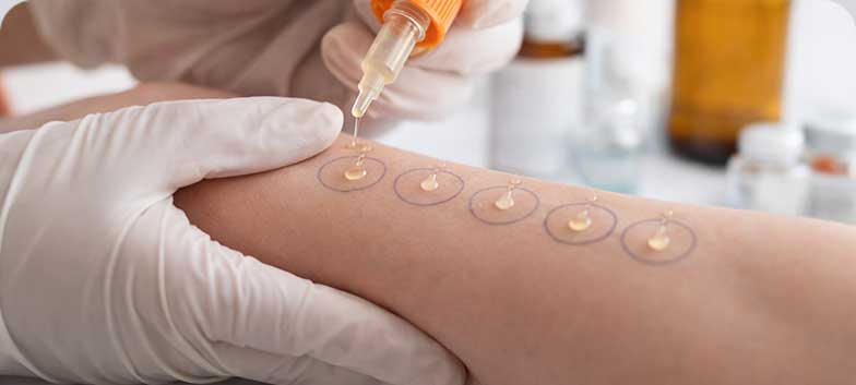 Testes cutâneos por picada