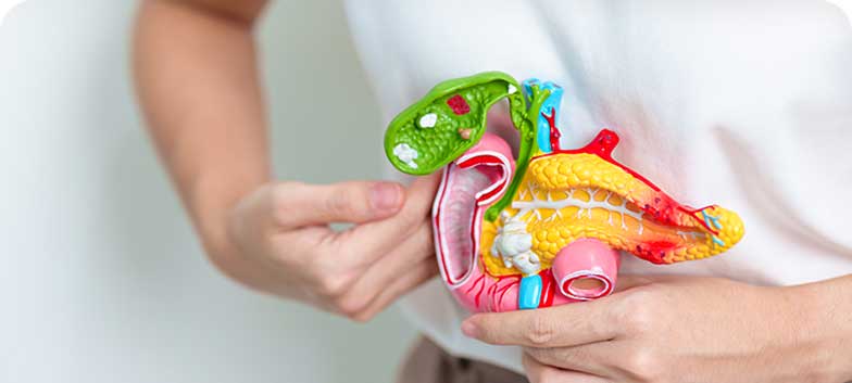 Litíase da Vesícula Biliar