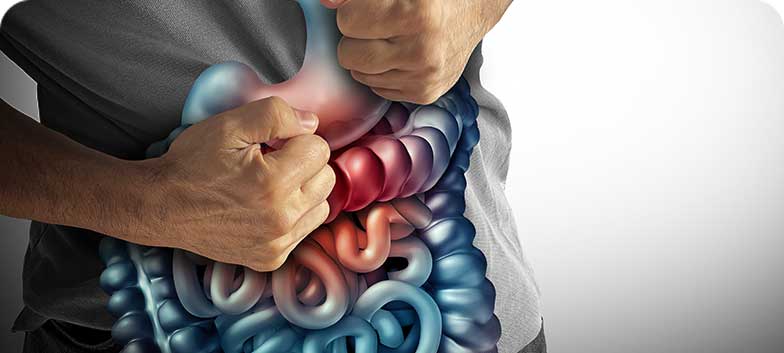 Doença Inflamatória do Intestino