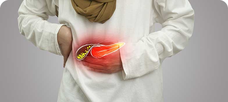 Litíase da Vesícula Biliar